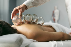 Soothe and Revive: Unveil Relief with Cupping Therapy at Get Physical Rx!
