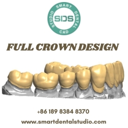 Transform Your Smile with Premier Full Crown Design in the USA